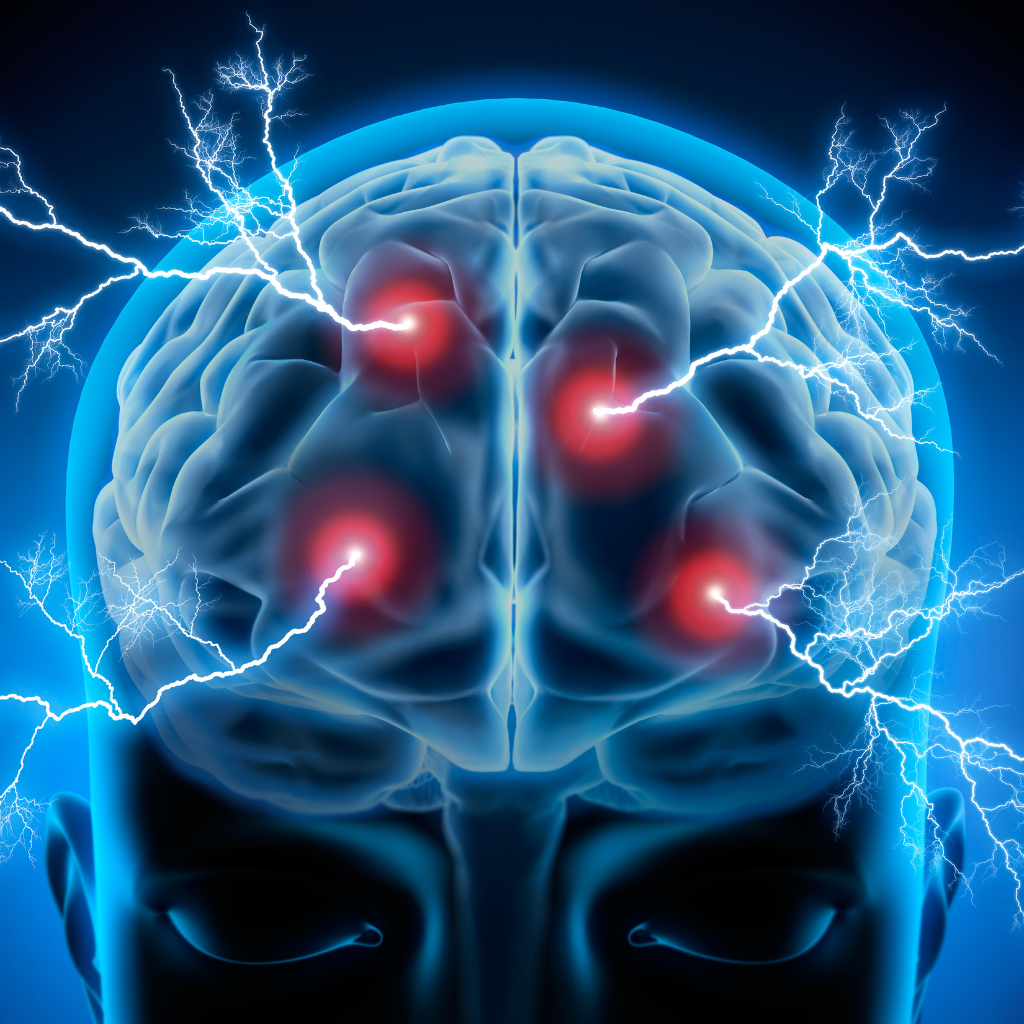 brain illustration showing targeted stimulation in areas linked to mood regulation