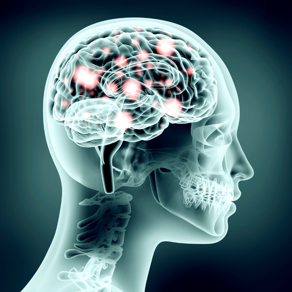 TMS Therapy Treatment Timeline: What to Expect Week by Week 1 Medical illustration of brain activity, showing how TMS uses magnetic pulses to stimulate mood-related brain areas.